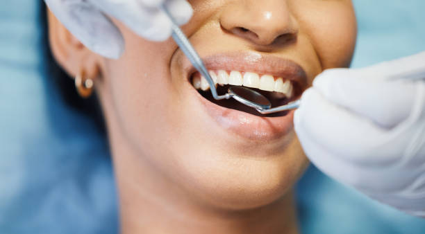 Best Emergency Dental Care for Trauma or Injury in Georgetown, CO